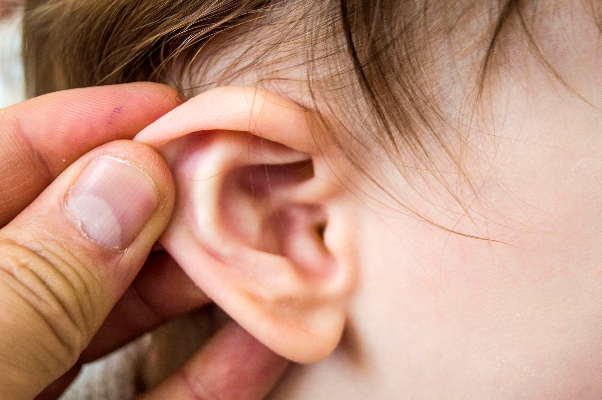 Read more about the article Your child has an ear-ache?